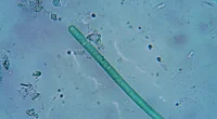 Cyanobakterier